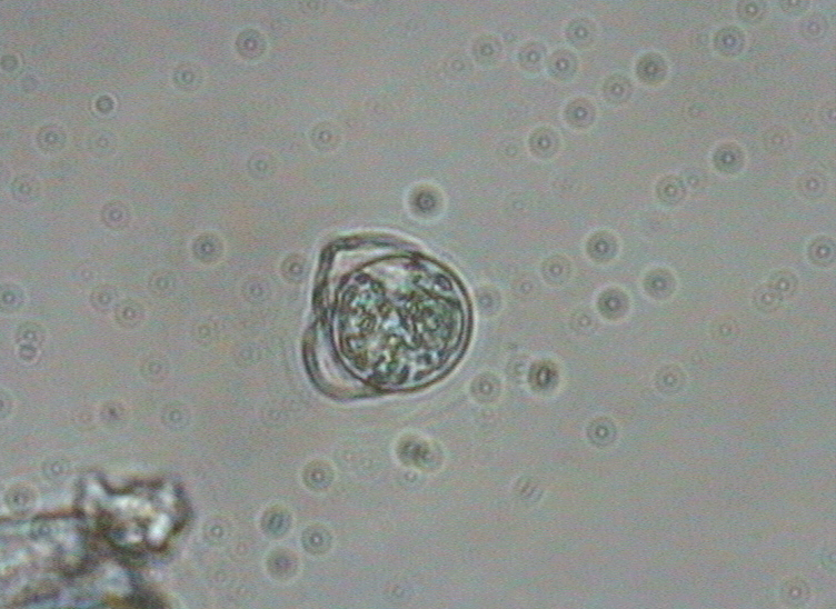 Dictyocha speculum